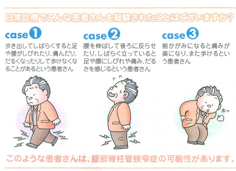 脊柱管狭窄症