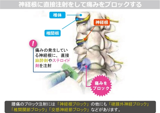 注射
